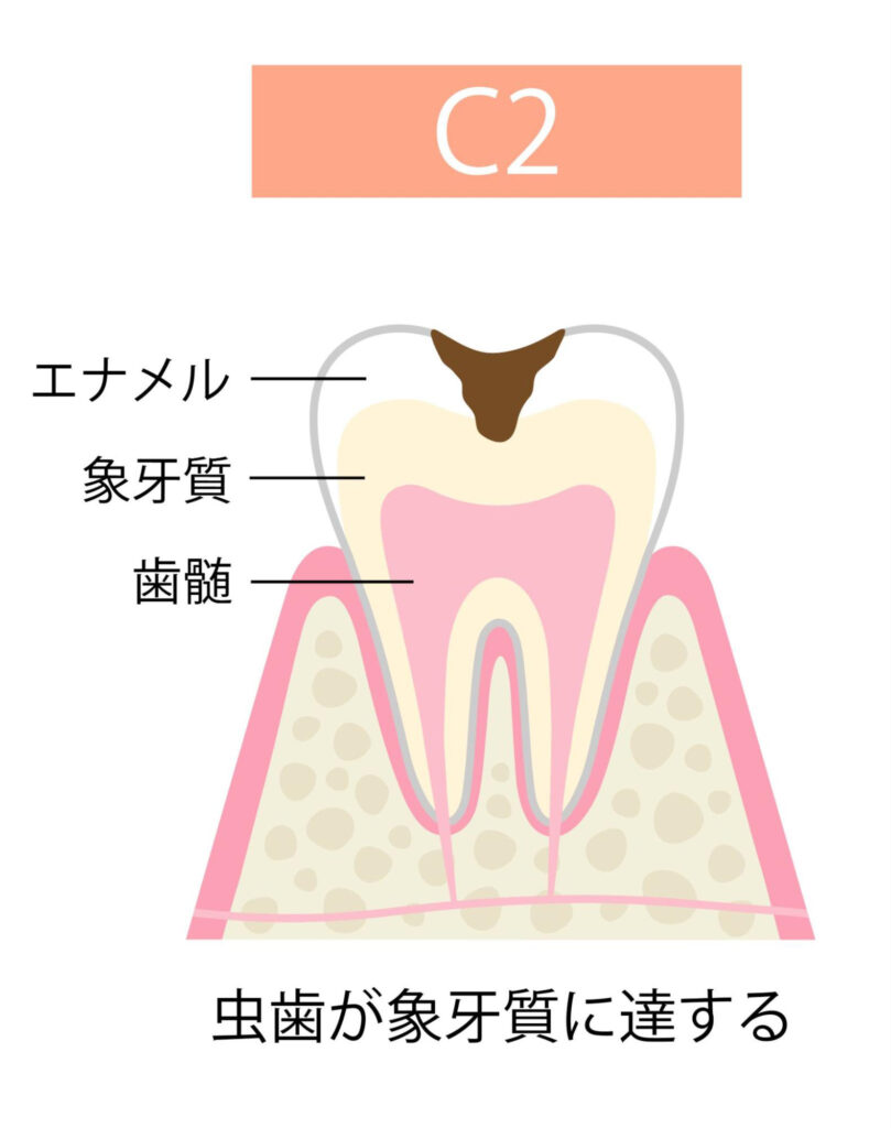 C2