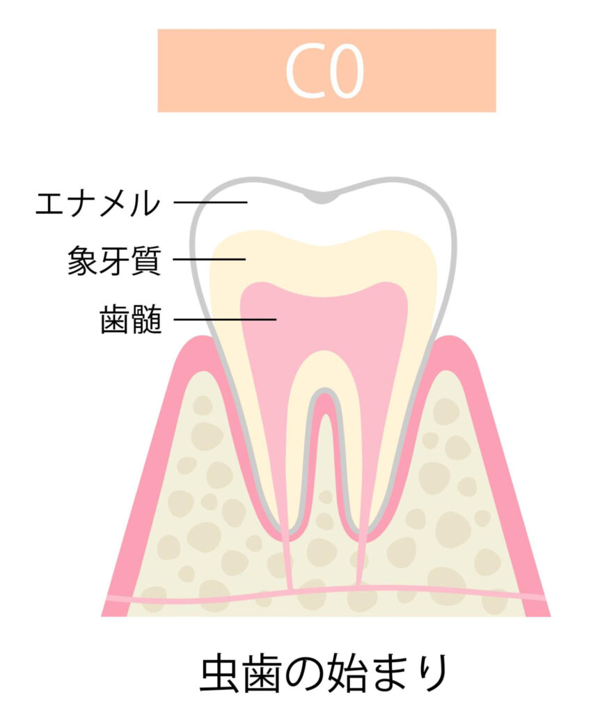 C0