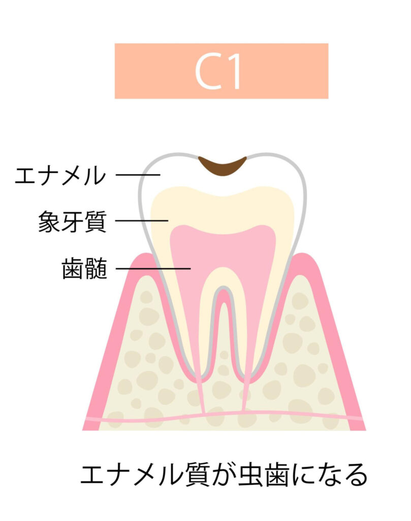 C1