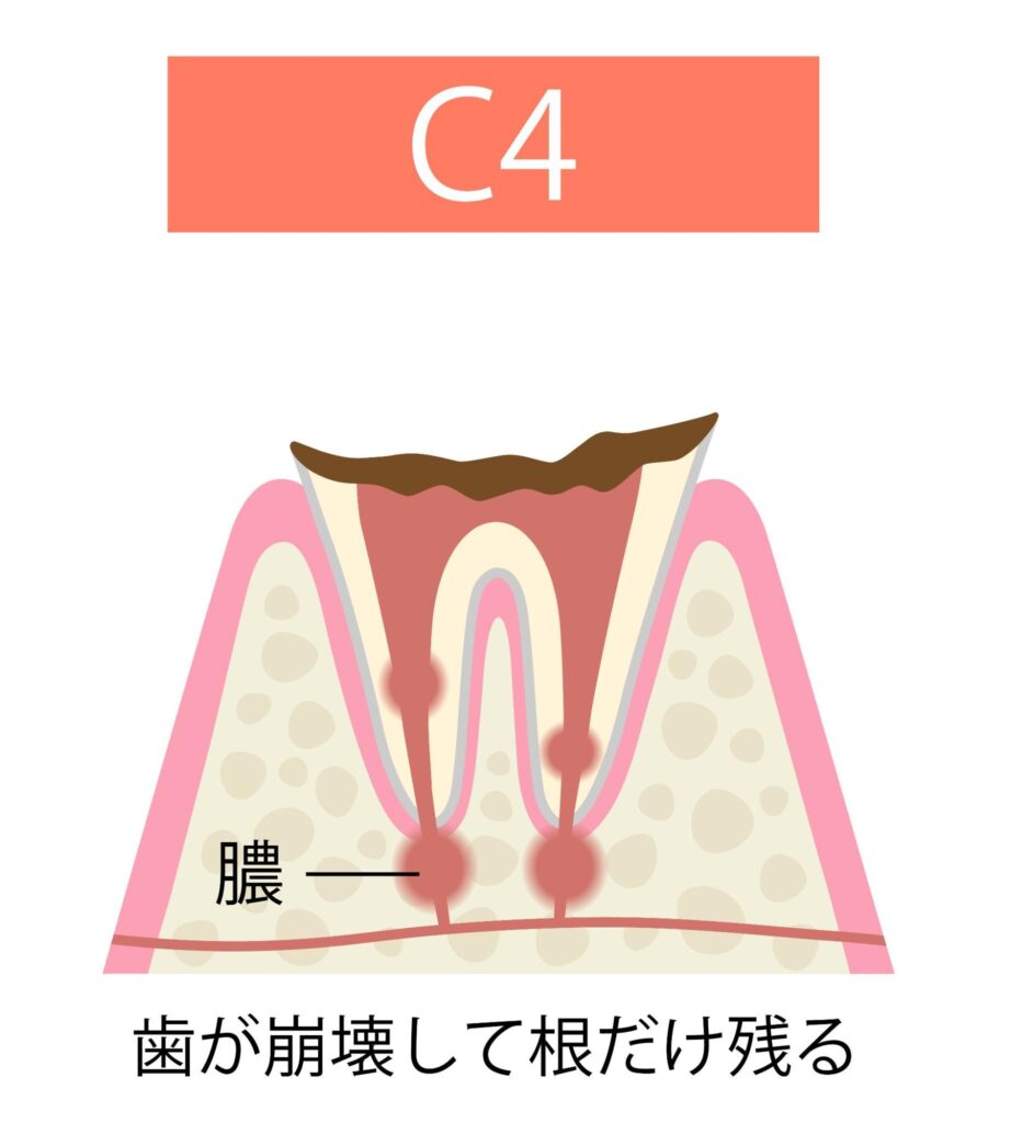 C4